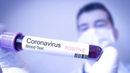 Wajib Tahu! Virus Corona Tak Berkutik dengan Cairan Ini
