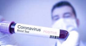 Update Korban Virus Corona 14 Februari: 65, 210 Terinfeksi, 1,486 Meninggal