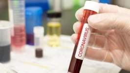 15 Kasus Baru Virus Corona, 1 Diantaranya WNI di Arab Saudi