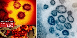 Bikin Geger, Ini Bentuk Virus Corona dari Mikroskop, Berduri Tajam dan Bermahkota