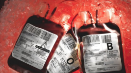 Benarkah Plasma Darah Efektif Jadi Obat Covid-19? Ini Penjelasan Ahli     