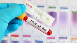 Nekat Mandikan Jenazah Pasien COVID-19, 17 Warga Sidoarjo Reaktif Rapid Test
