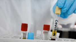 Vaksin Corona Oxford Siap Produksi Setelah Bill Gates Kucurkan Dana