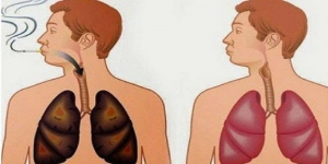 Ini 5 Cara Alami yang Ampuh Bersihkan Paru-paru dari Sisa Nikotin 
