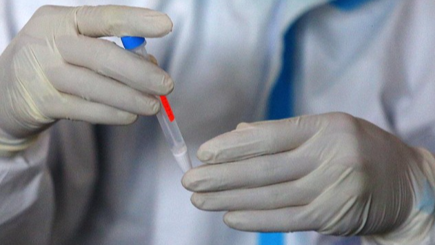 Rapid Test Antigen Jadi Kunci Pintu Wisata, Berikut Harga Lengkapnya di Jakarta