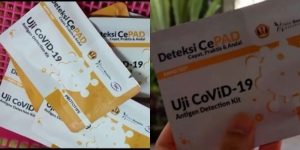 Unpad Susul UGM Ciptakan Alat Tes CePAD untuk Deteksi Covid-19