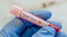 Daftar Gejala Virus Nipah yang Berpotensi Jadi Pandemi Baru di Tengah Covid-19 di Asia
