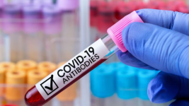 Ahli Sebut Antibodi dari Vaksin Covid-19 Bertahan Hanya 6 Bulan, Masyarakat Diminta Waspada