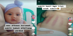 Viral Video Bayi Sakit Diobati dengan Cara Dikerok Sampai Merah, Ibunya Dikecam Netizen