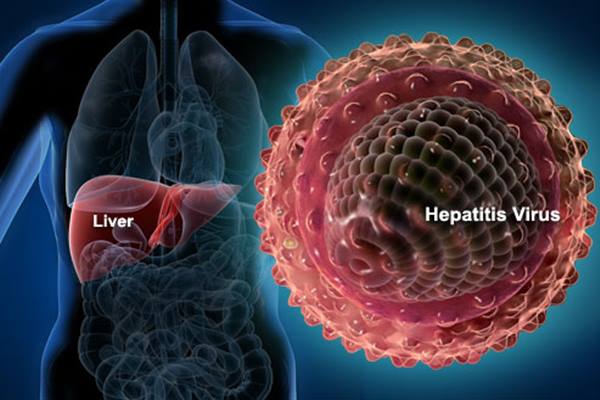 Fakta Terbaru Hepatitis Misterius, Renggut Nyawa hingga Demam jadi Gejala Paling Tinggi