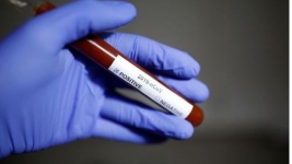 Mengejutkan, 2.715 Orang Tewas Akibat Virus Corona di China