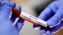 88 Pasien Dinyatakan Sembuh dari Virus Corona di Korsel, 5.766 Orang Lainnya Terinfeksi